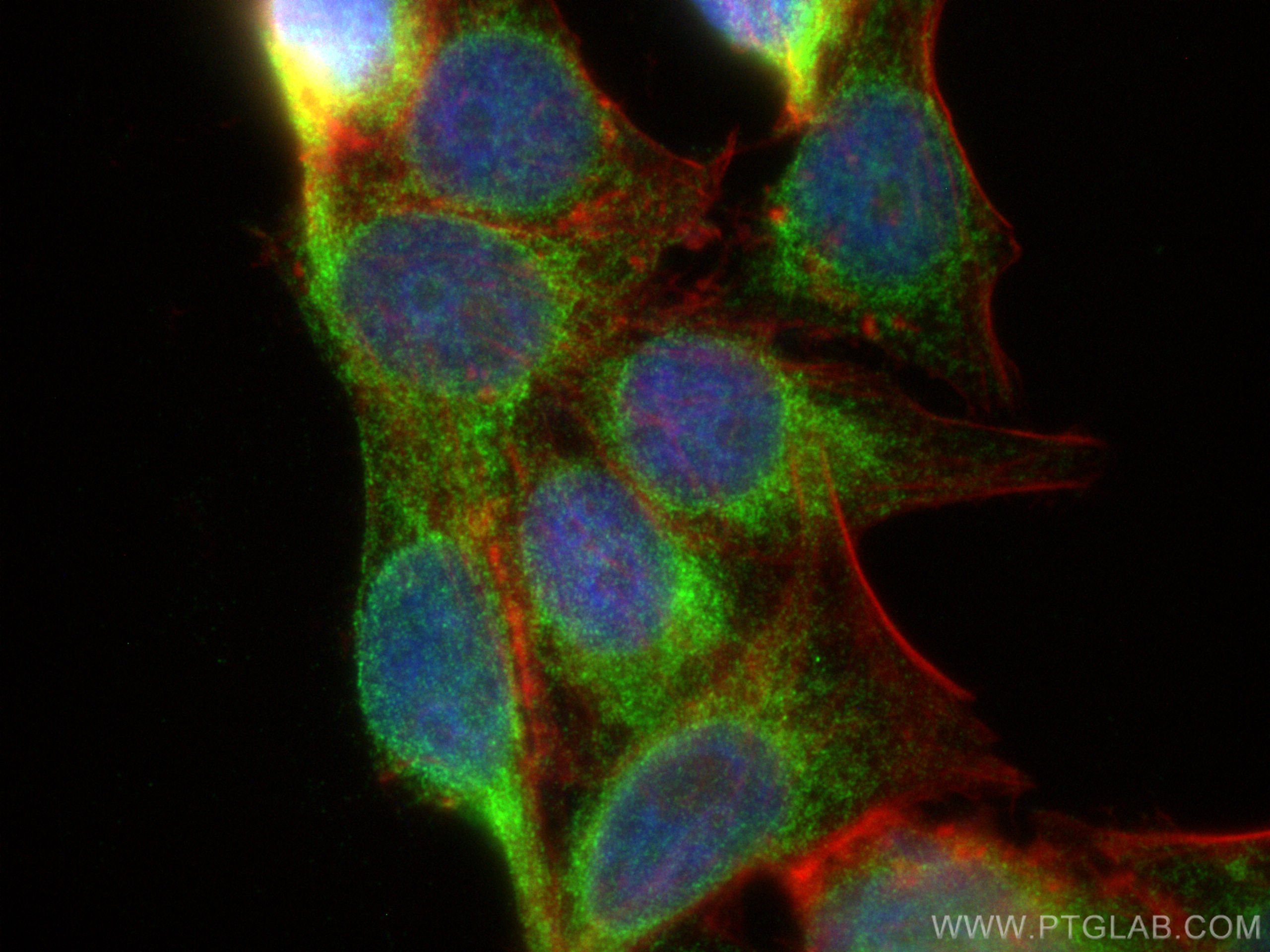 Immunofluorescence (IF) / fluorescent staining of HepG2 cells using TMEM38B Polyclonal antibody (19919-1-AP)