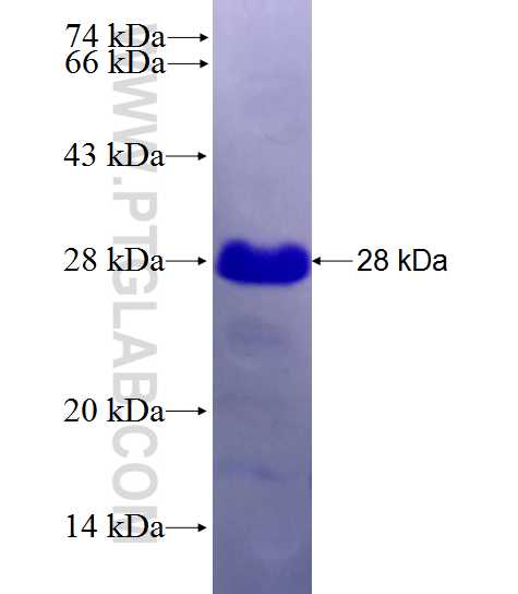 TMEM40 fusion protein Ag27908 SDS-PAGE