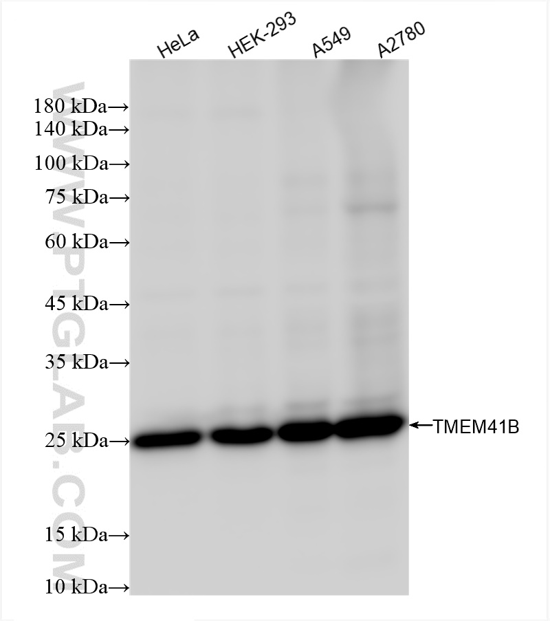 Western Blot (WB) analysis of various lysates using TMEM41B Recombinant antibody (84510-4-RR)