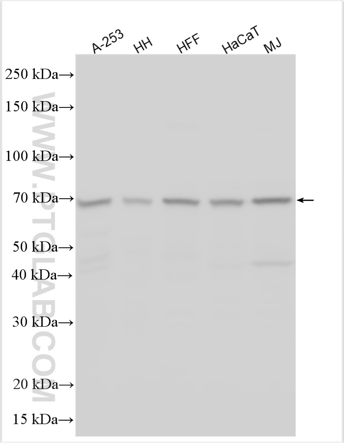 Western Blot (WB) analysis of various lysates using TMEM45A Polyclonal antibody (27534-1-AP)