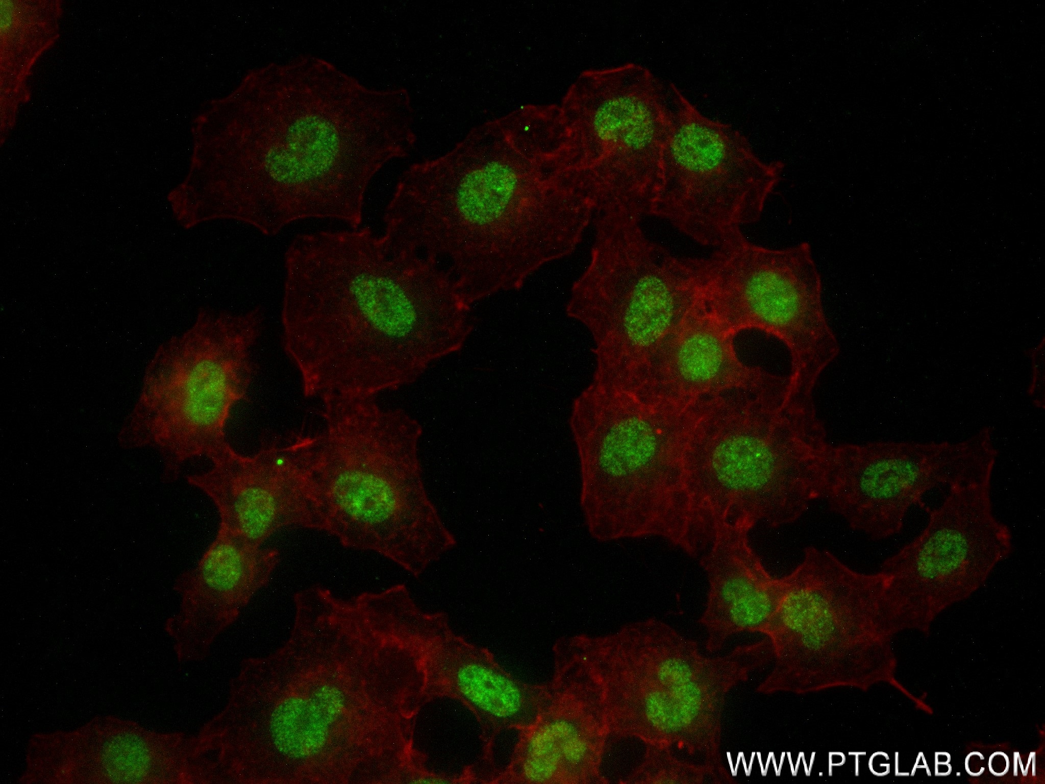 Immunofluorescence (IF) / fluorescent staining of A549 cells using TMEM53 Recombinant antibody (83554-3-RR)