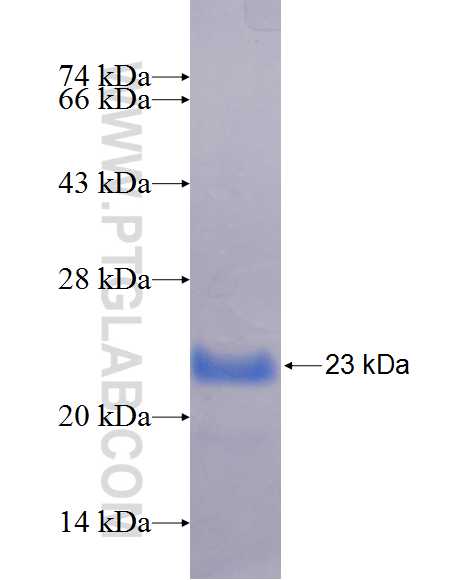 TMEM57 fusion protein Ag24421 SDS-PAGE