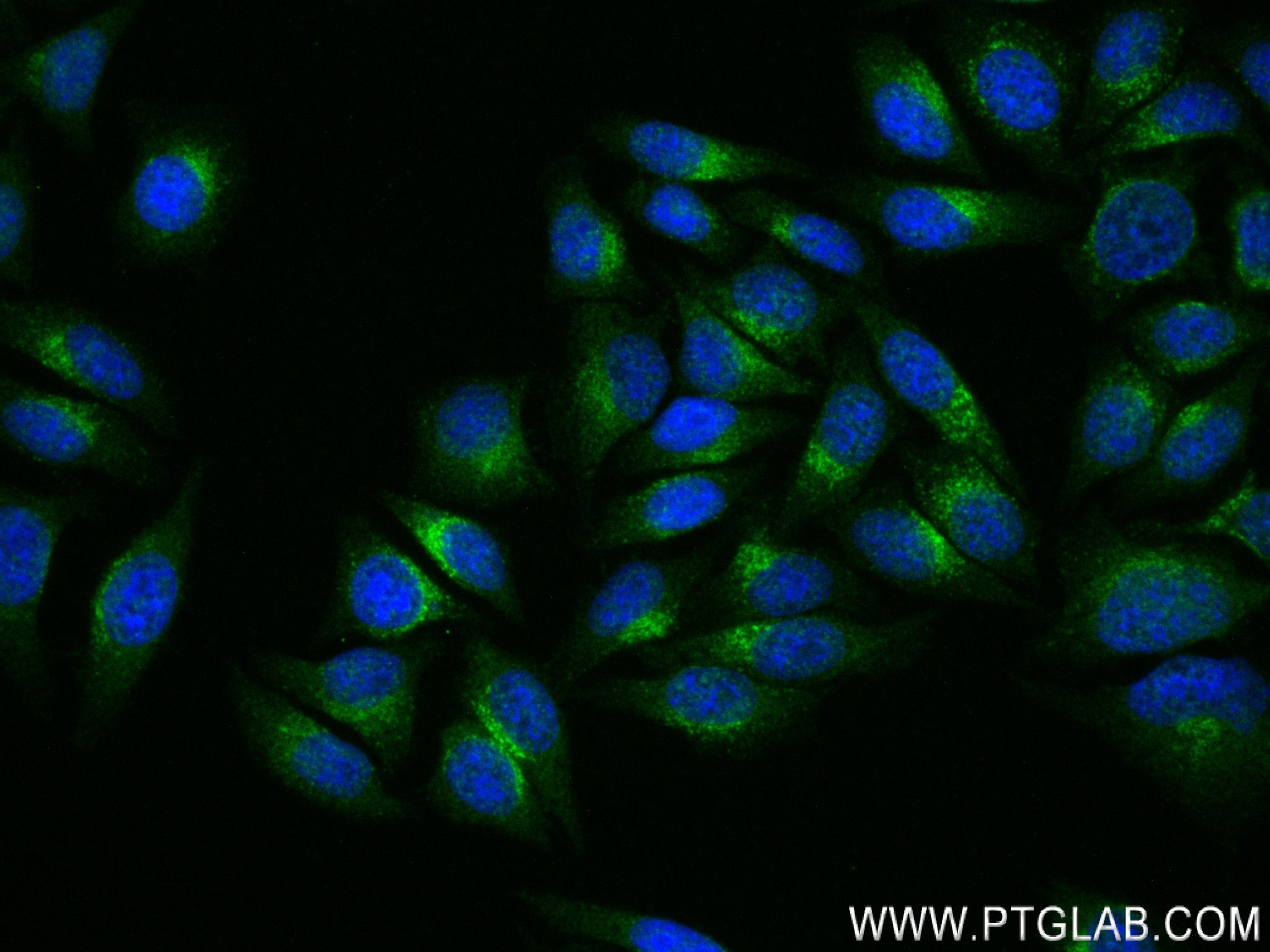 Immunofluorescence (IF) / fluorescent staining of HepG2 cells using TMEM59 Recombinant antibody (83656-3-RR)