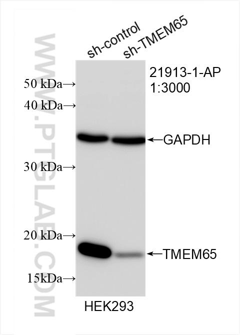 Western Blot (WB) analysis of HEK-293 cells using TMEM65 Polyclonal antibody (21913-1-AP)