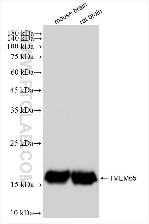 Western Blot (WB) analysis of various lysates using TMEM65 Recombinant antibody (83219-4-RR)