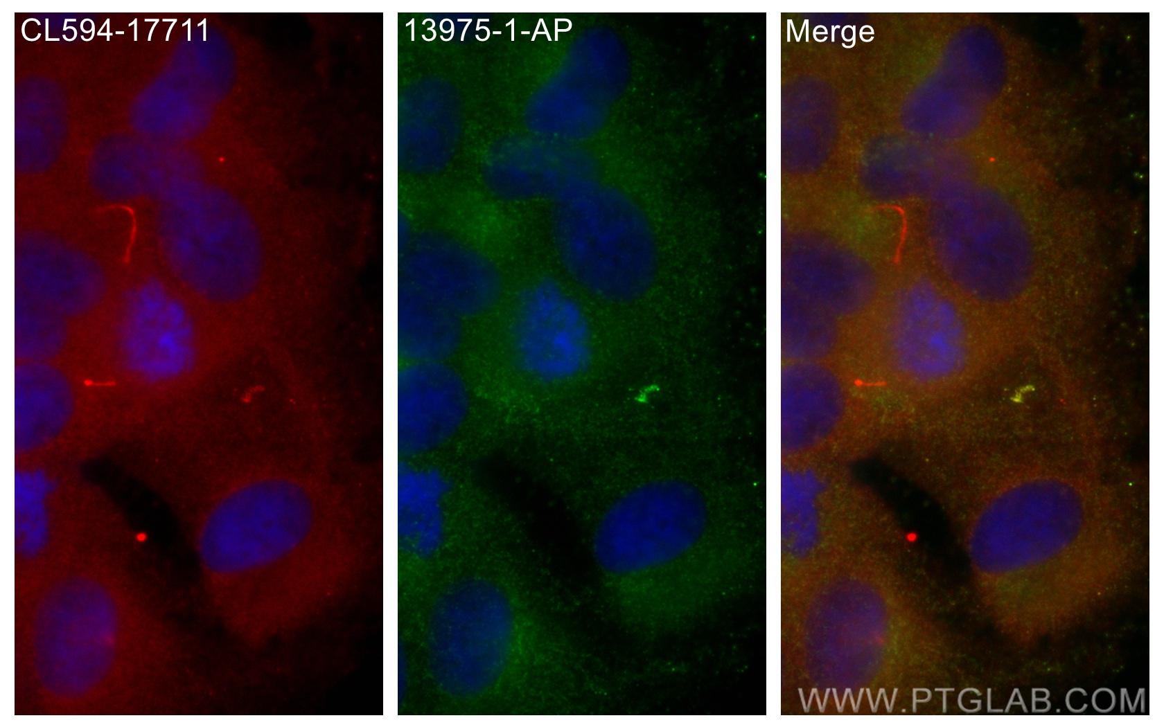 Immunofluorescence (IF) / fluorescent staining of hTERT-RPE1 cells using MKS3 Polyclonal antibody (13975-1-AP)