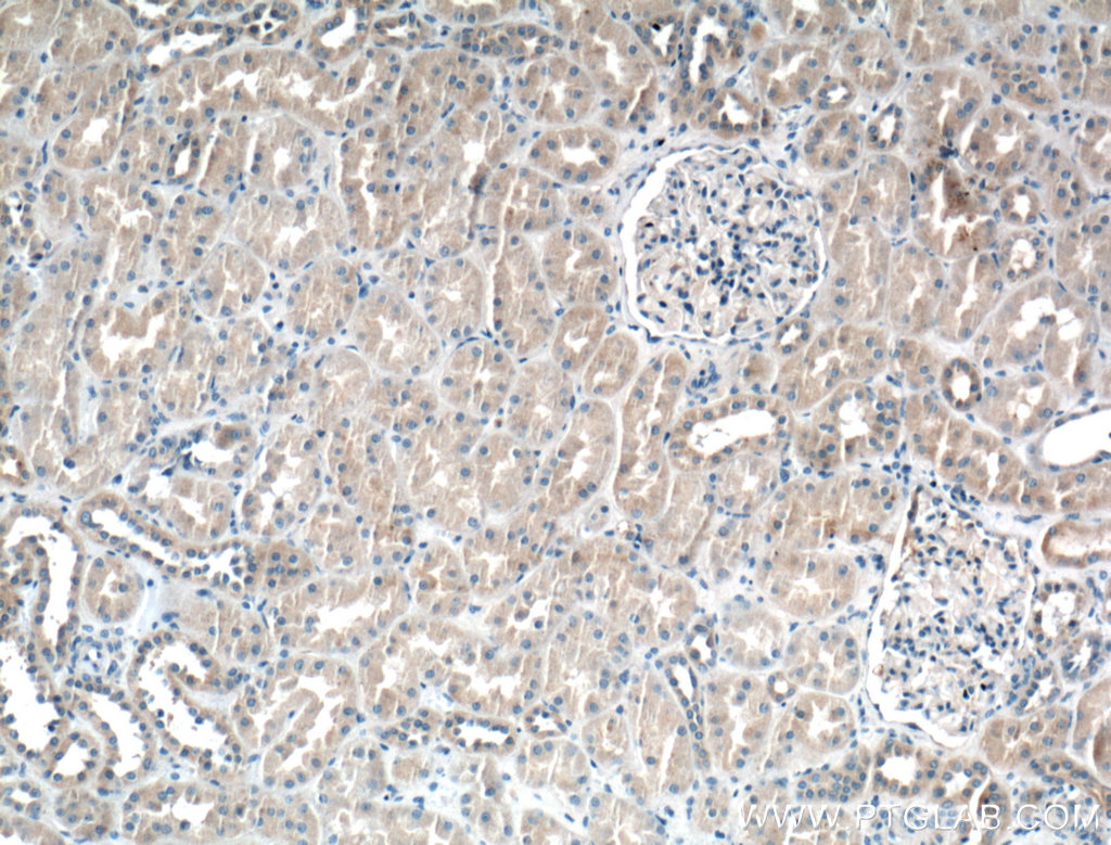 Immunohistochemistry (IHC) staining of human kidney tissue using MKS3 Polyclonal antibody (13975-1-AP)