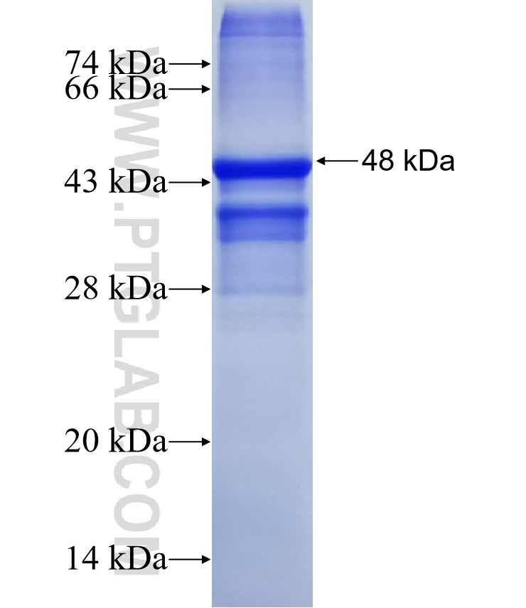 TMEM72 fusion protein Ag21553 SDS-PAGE