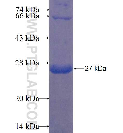 TMEM74 fusion protein Ag22359 SDS-PAGE