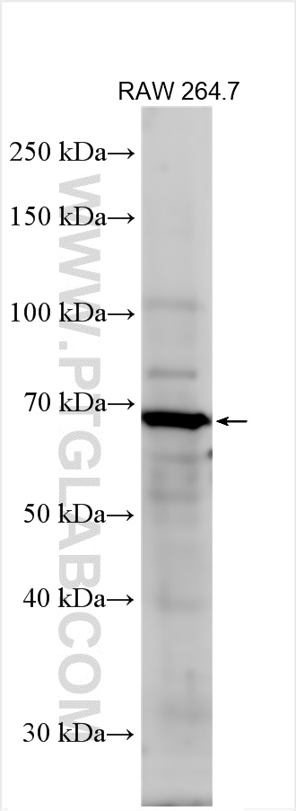 Western Blot (WB) analysis of various lysates using TMEM87A Polyclonal antibody (25091-1-AP)