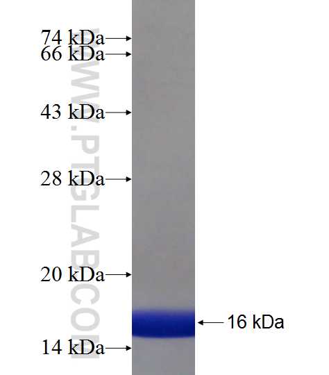 TMEM87A fusion protein Ag19117 SDS-PAGE