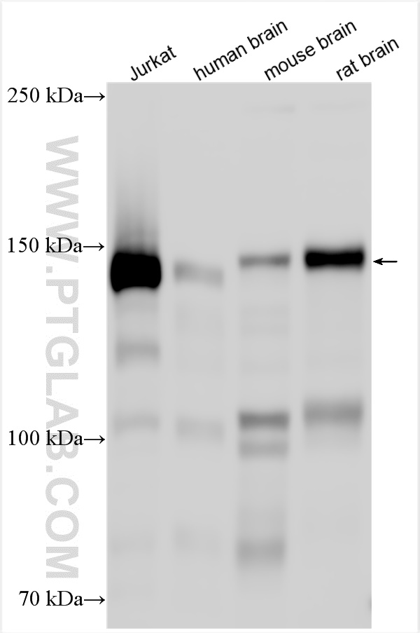 Western Blot (WB) analysis of various lysates using TMF1 Polyclonal antibody (22212-1-AP)