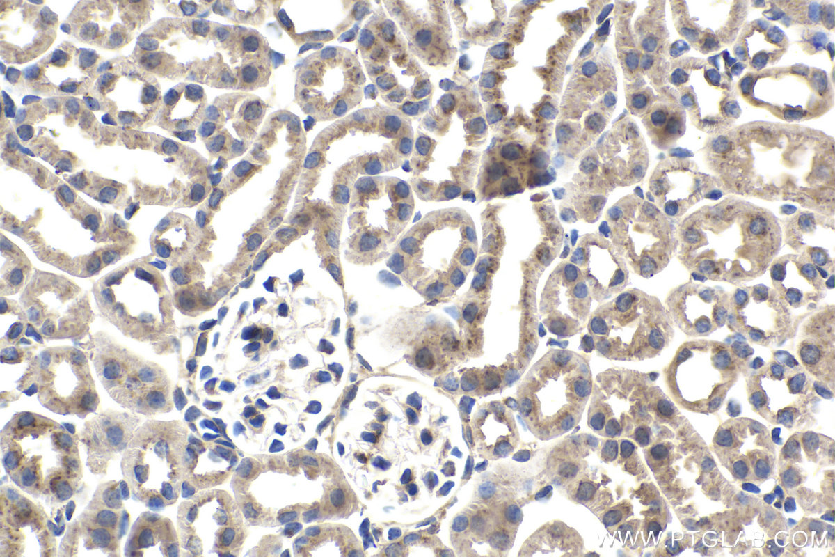 Immunohistochemistry (IHC) staining of mouse kidney tissue using TMF1 Monoclonal antibody (67505-1-Ig)