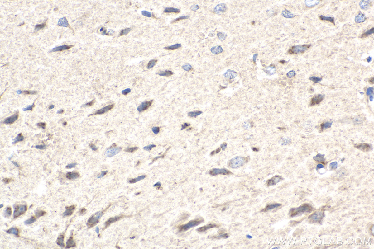 Immunohistochemistry (IHC) staining of rat brain tissue using TMF1 Monoclonal antibody (67505-1-Ig)