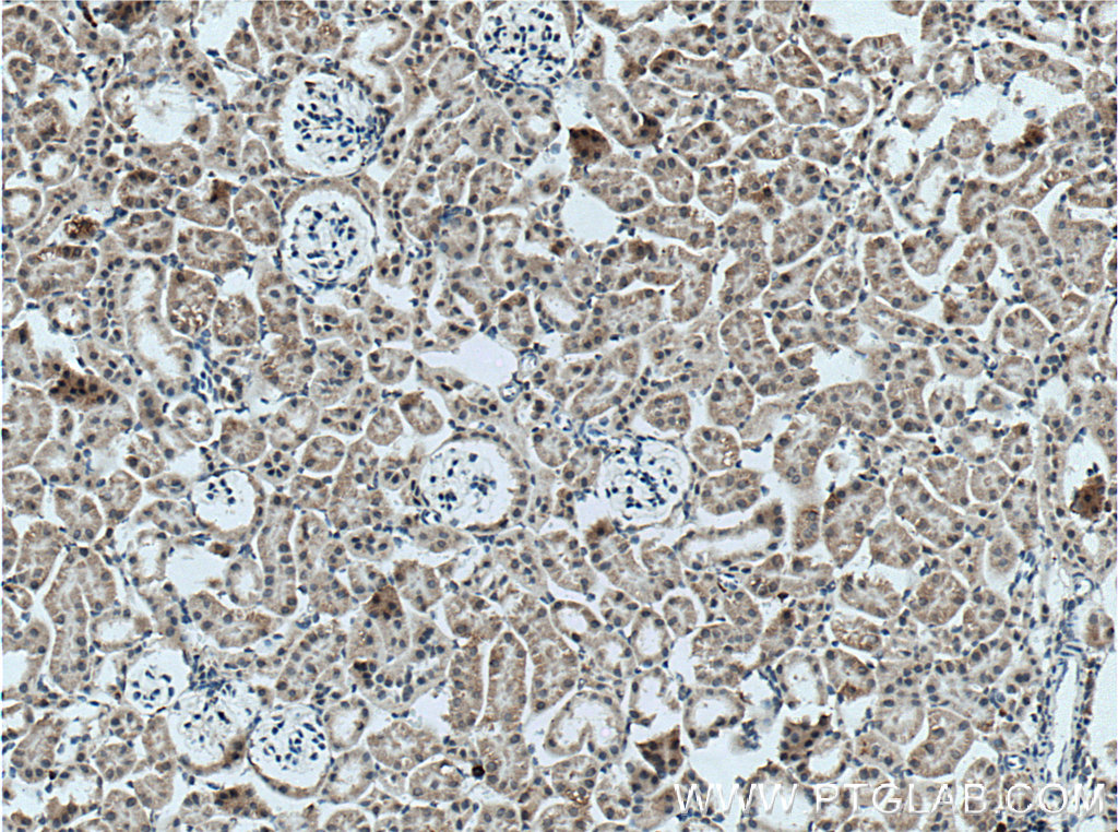 Immunohistochemistry (IHC) staining of mouse kidney tissue using TMIGD1 Polyclonal antibody (27174-1-AP)