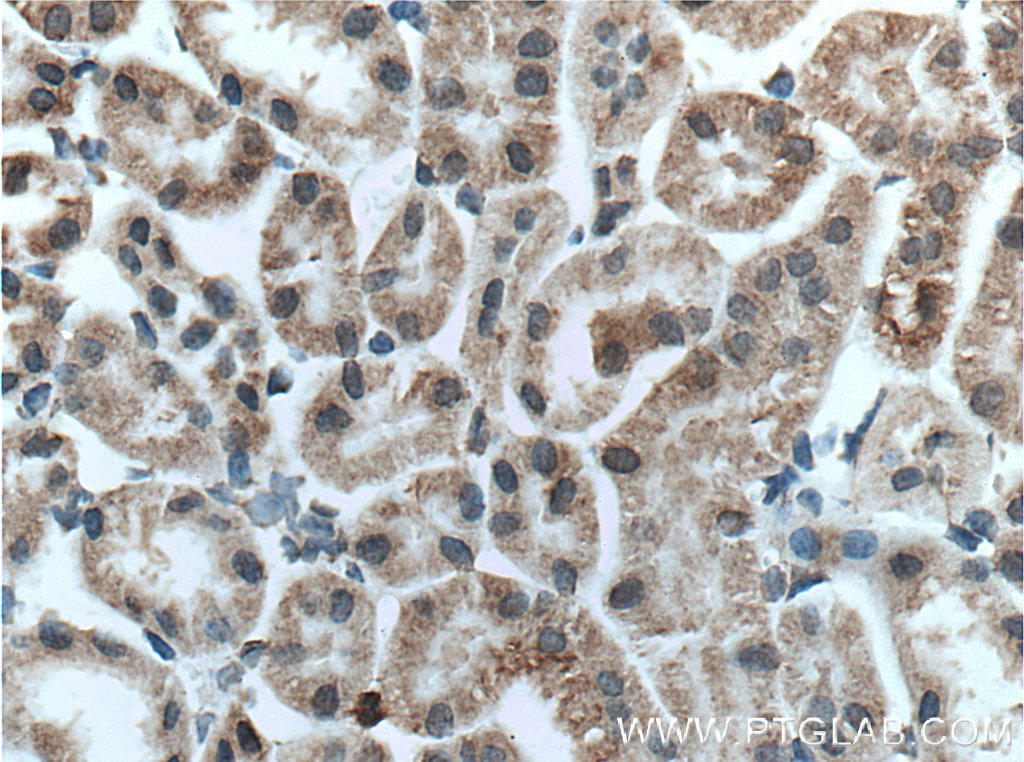 Immunohistochemistry (IHC) staining of mouse kidney tissue using TMIGD1 Polyclonal antibody (27174-1-AP)