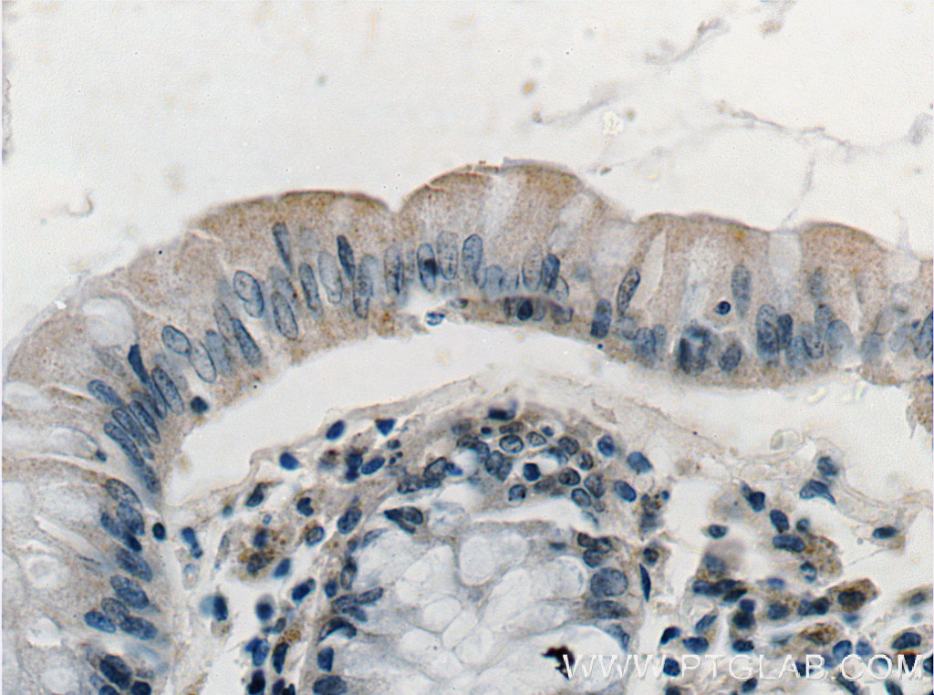 Immunohistochemistry (IHC) staining of human colon tissue using TMIGD1 Polyclonal antibody (27174-1-AP)