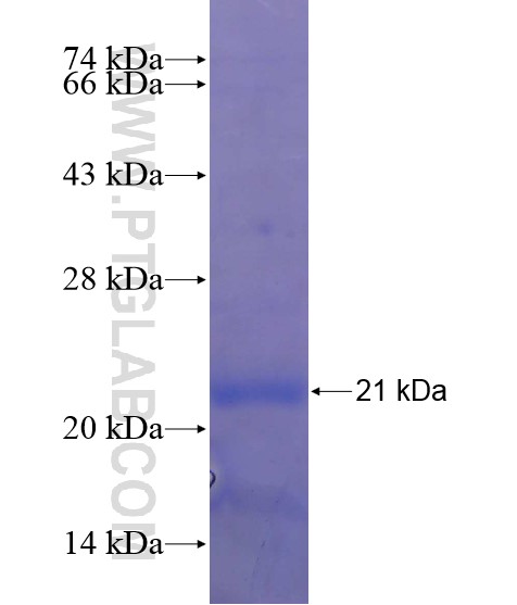 TMIGD1 fusion protein Ag19612 SDS-PAGE