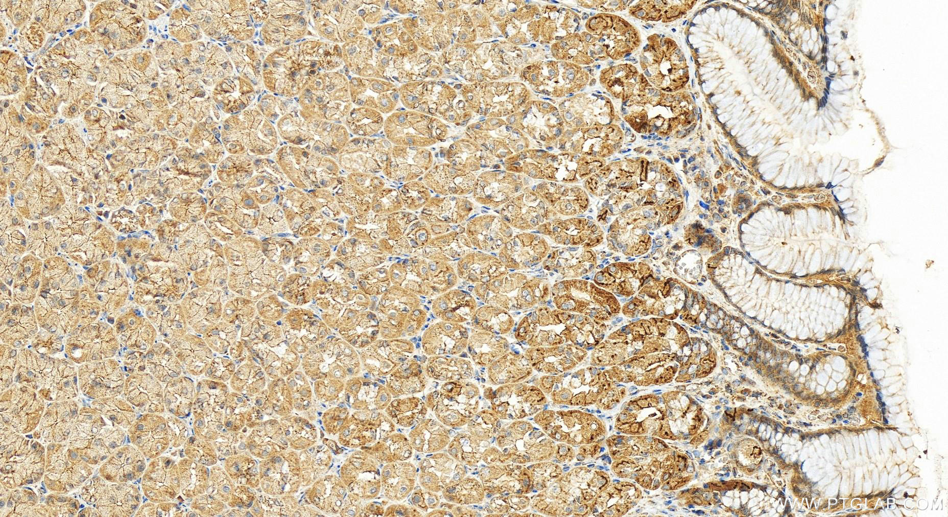 Immunohistochemistry (IHC) staining of human stomach tissue using TMLHE Polyclonal antibody (16621-1-AP)