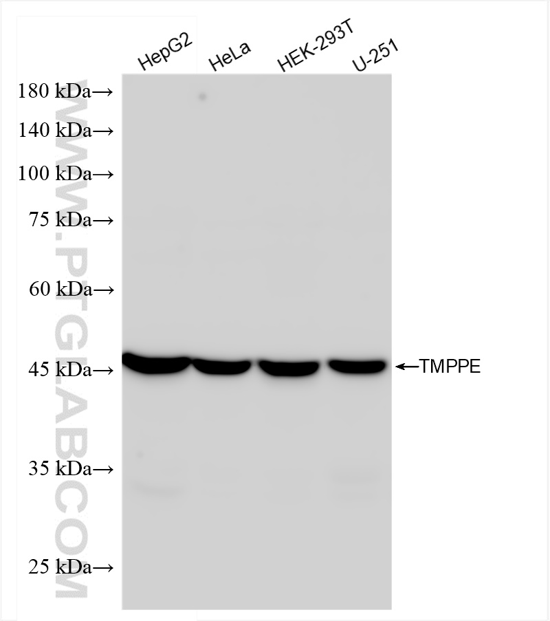 Western Blot (WB) analysis of various lysates using TMPPE Recombinant antibody (84028-2-RR)