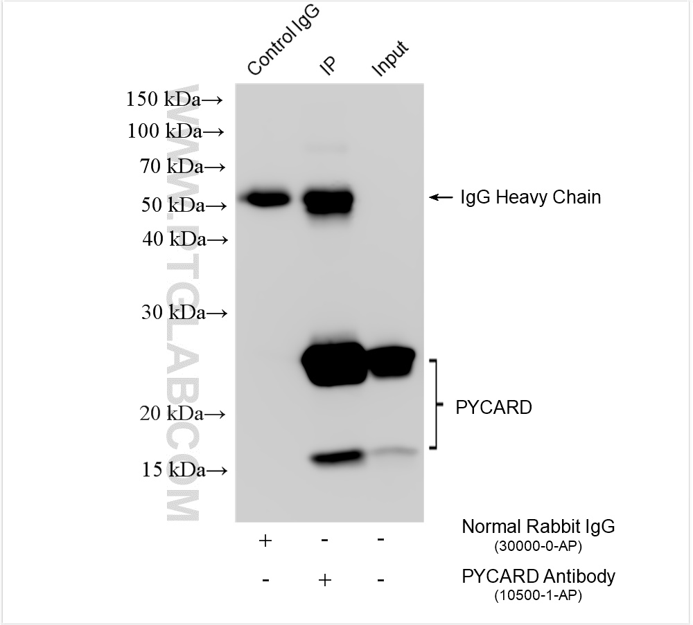 Immunoprecipitation (IP) experiment of HL-60 cells using ASC/TMS1 Polyclonal antibody (10500-1-AP)