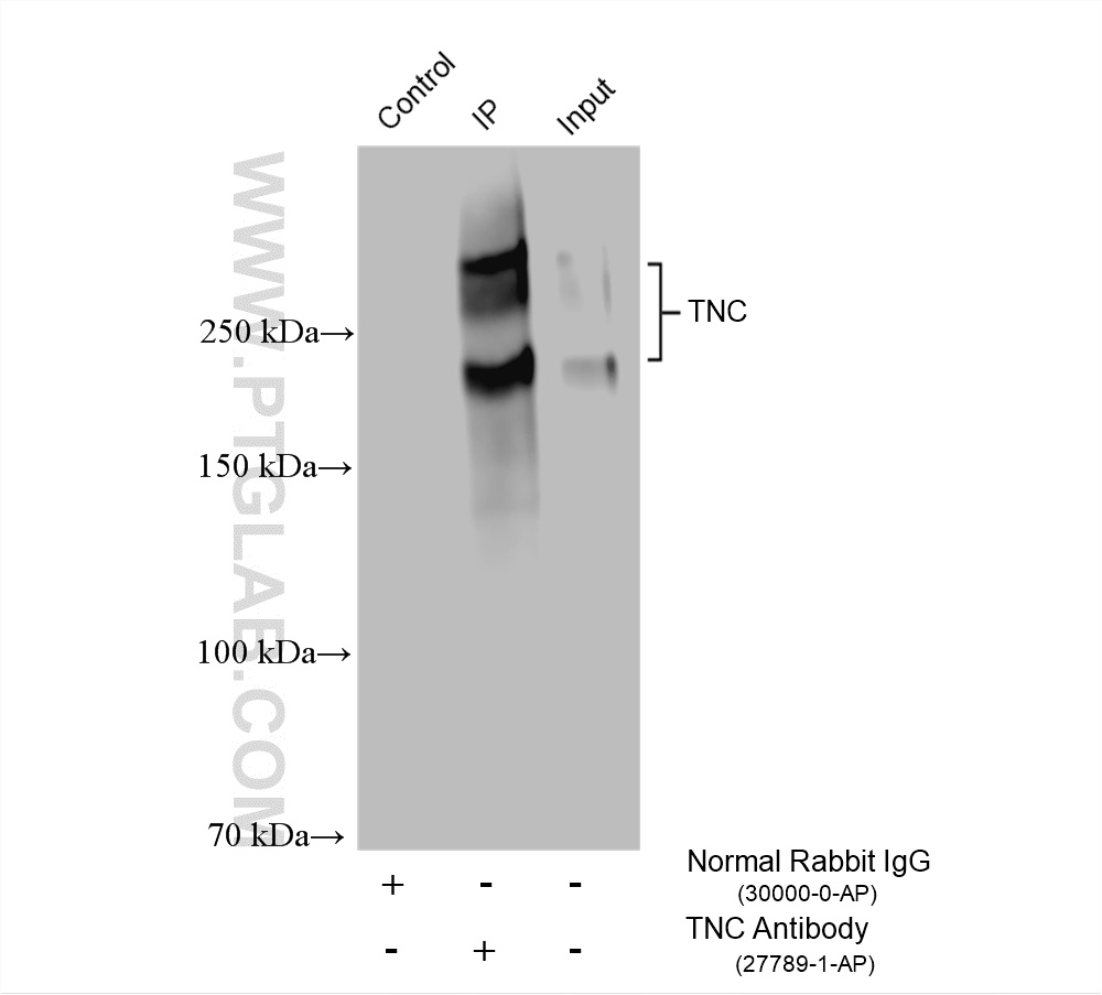 Immunoprecipitation (IP) experiment of U-87 MG cells using TNC/Tenascin-C Polyclonal antibody (27789-1-AP)