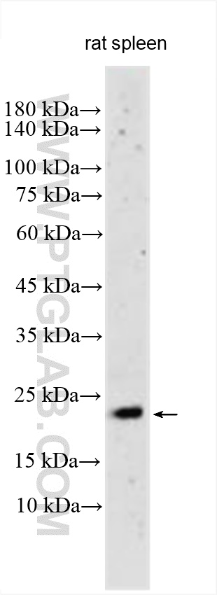 Western Blot (WB) analysis of rat spleen tissue using TNF Beta Polyclonal antibody (31505-1-AP)