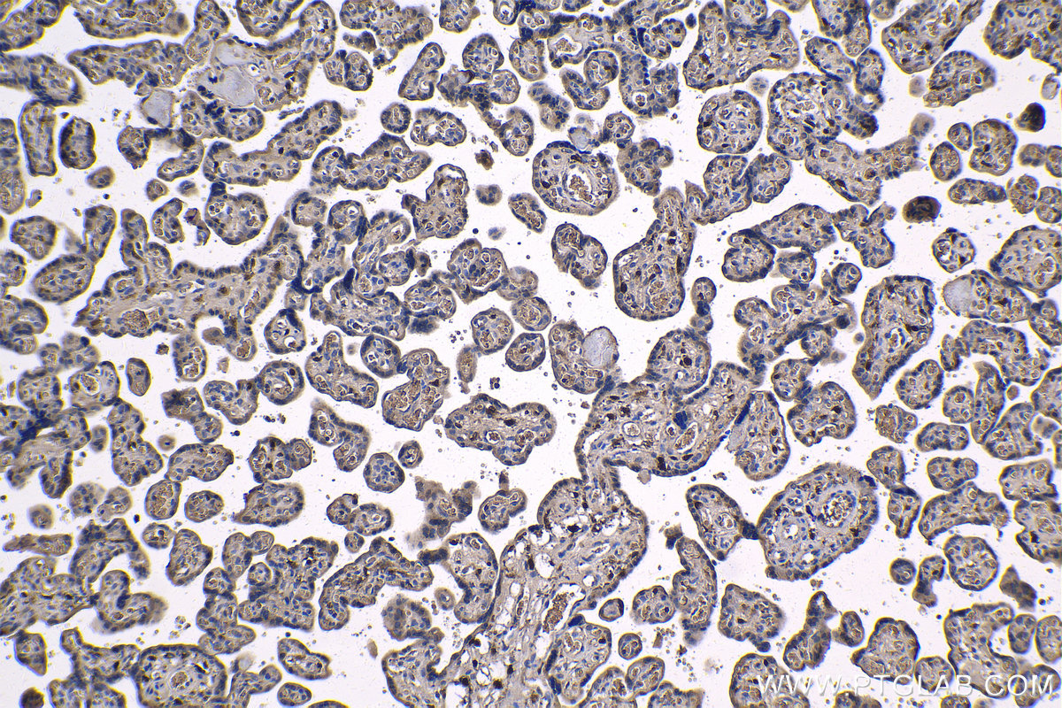 Immunohistochemistry (IHC) staining of human placenta tissue using TNF-alpha Monoclonal antibody (60291-1-Ig)