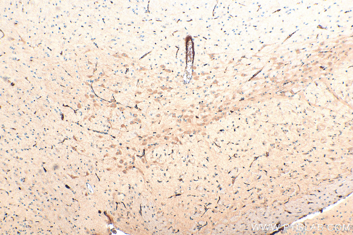Immunohistochemistry (IHC) staining of mouse brain tissue using TNFR1/CD120a Polyclonal antibody (21574-1-AP)