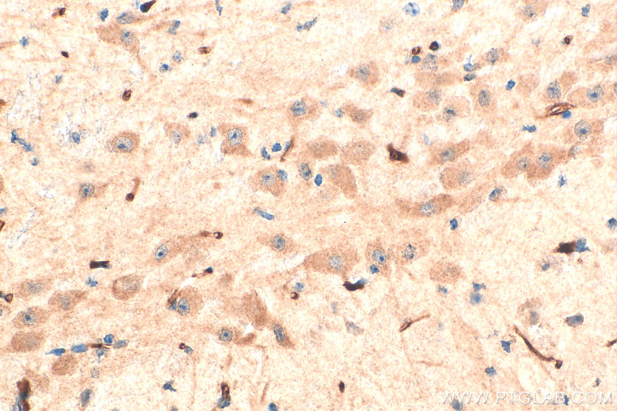 Immunohistochemistry (IHC) staining of mouse brain tissue using TNFR1/CD120a Polyclonal antibody (21574-1-AP)