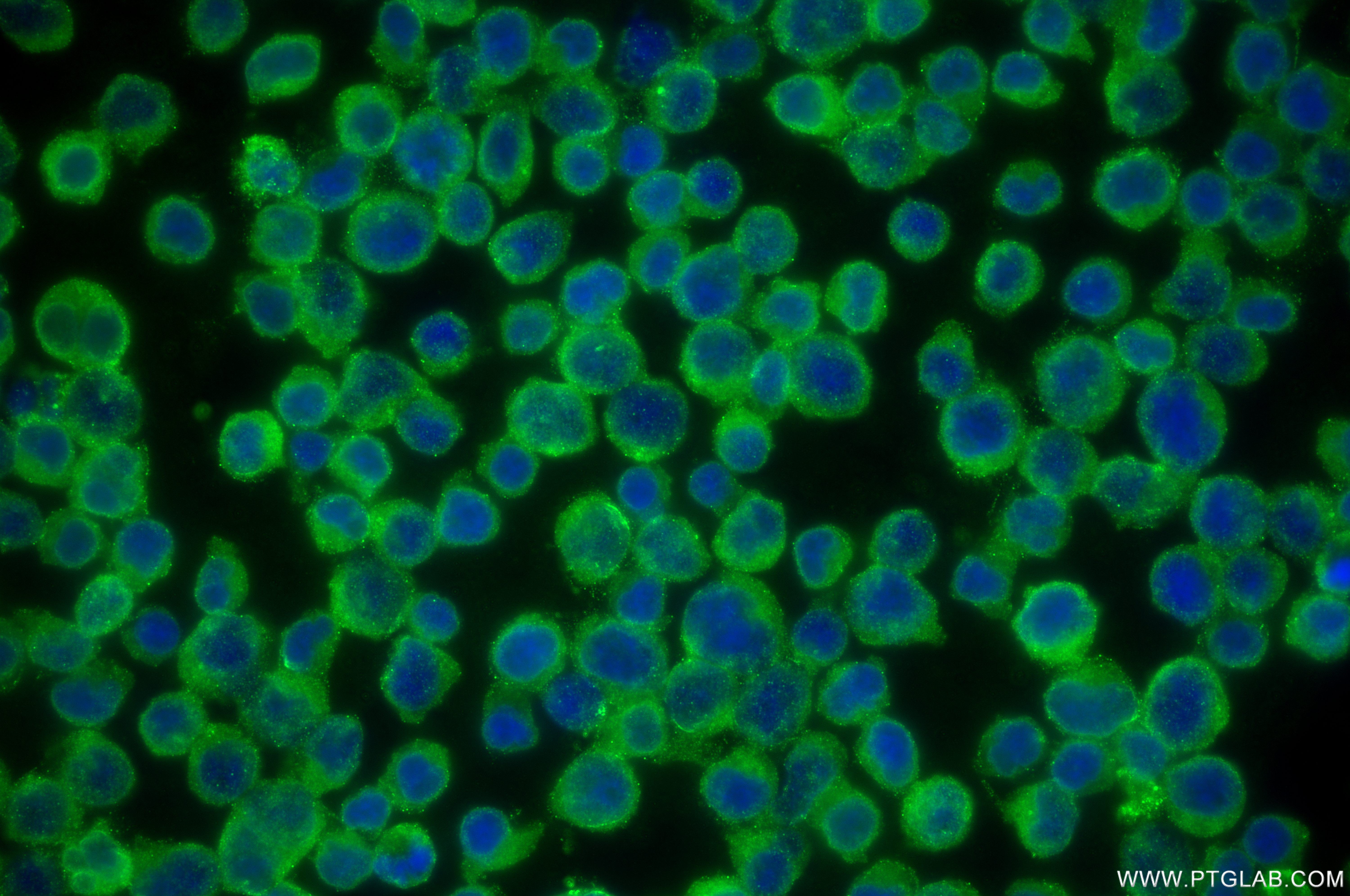 Immunofluorescence (IF) / fluorescent staining of Jurkat cells using TNFR1/CD120a Recombinant antibody (84243-5-RR)