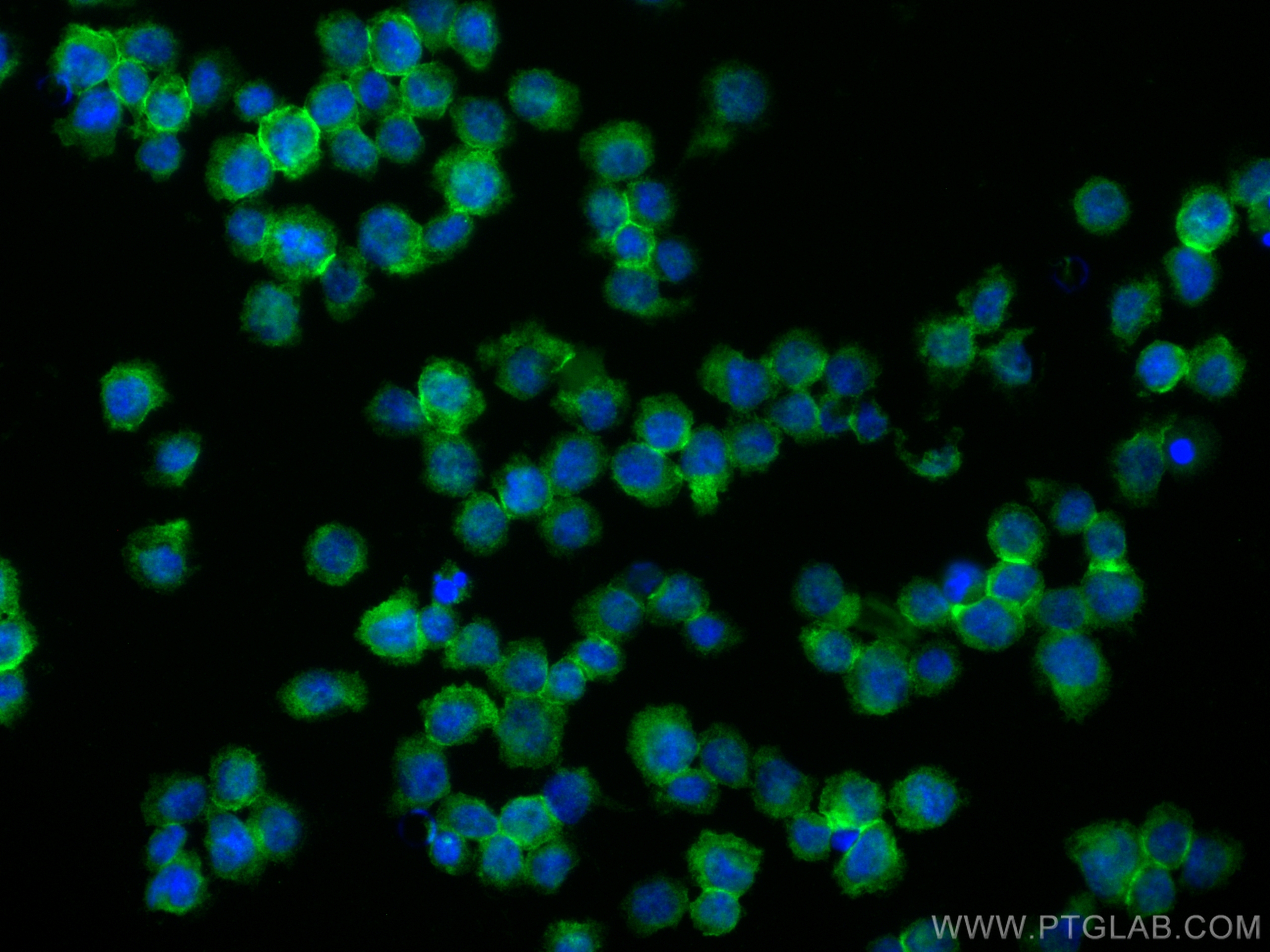 Immunofluorescence (IF) / fluorescent staining of THP-1 cells using TNFR2 / TNFRSF1B Polyclonal antibody (19272-1-AP)