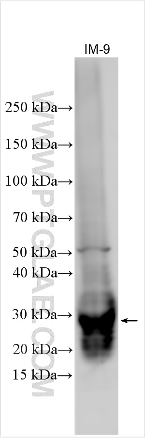 Western Blot (WB) analysis of various lysates using TNFRSF13B/CD267 Polyclonal antibody (21520-1-AP)