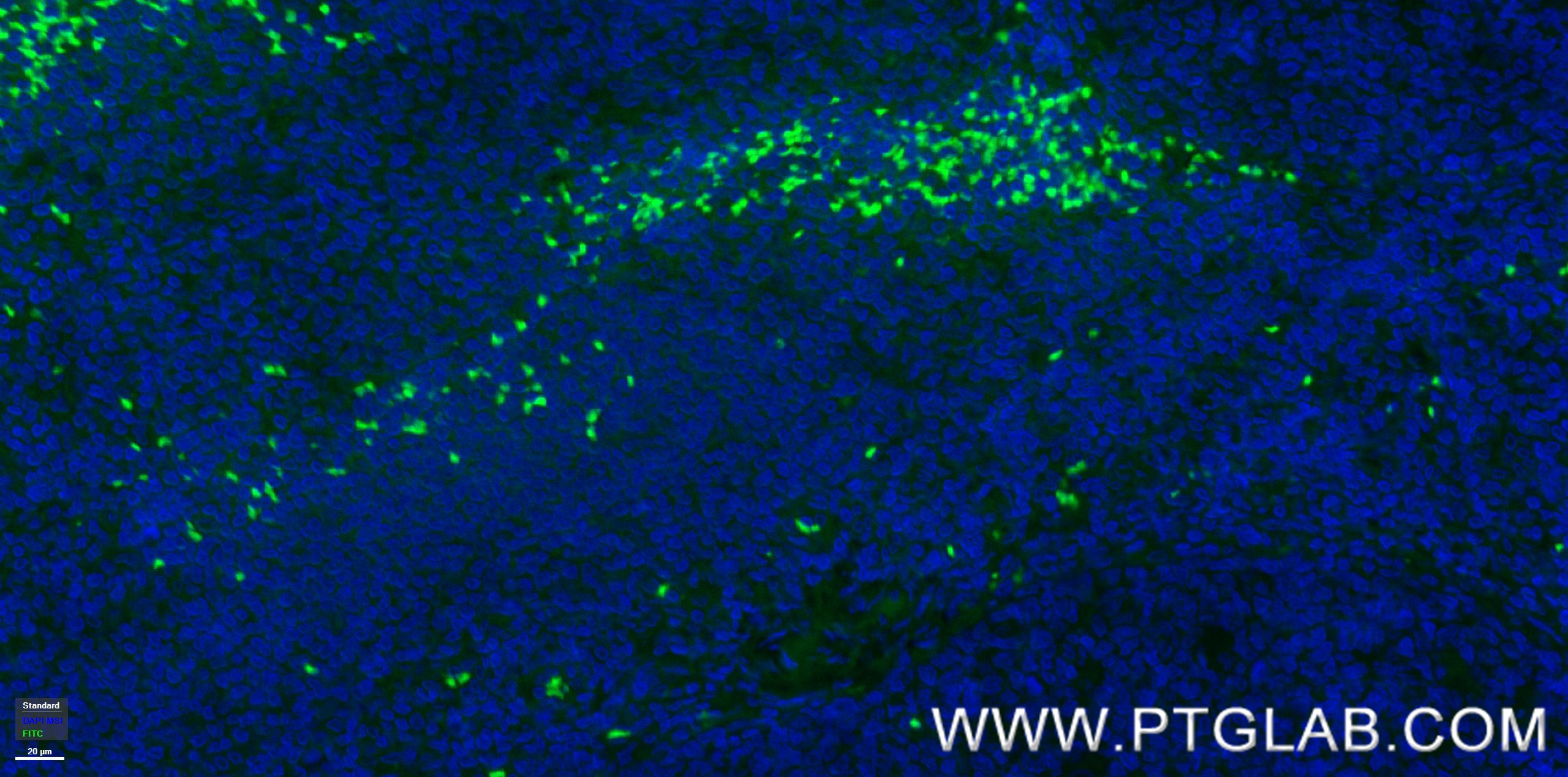 Immunofluorescence (IF) / fluorescent staining of human tonsillitis tissue using Anti-Human TNFRSF9/CD137 Rabbit Recombinant Antibo (98112-1-RR)