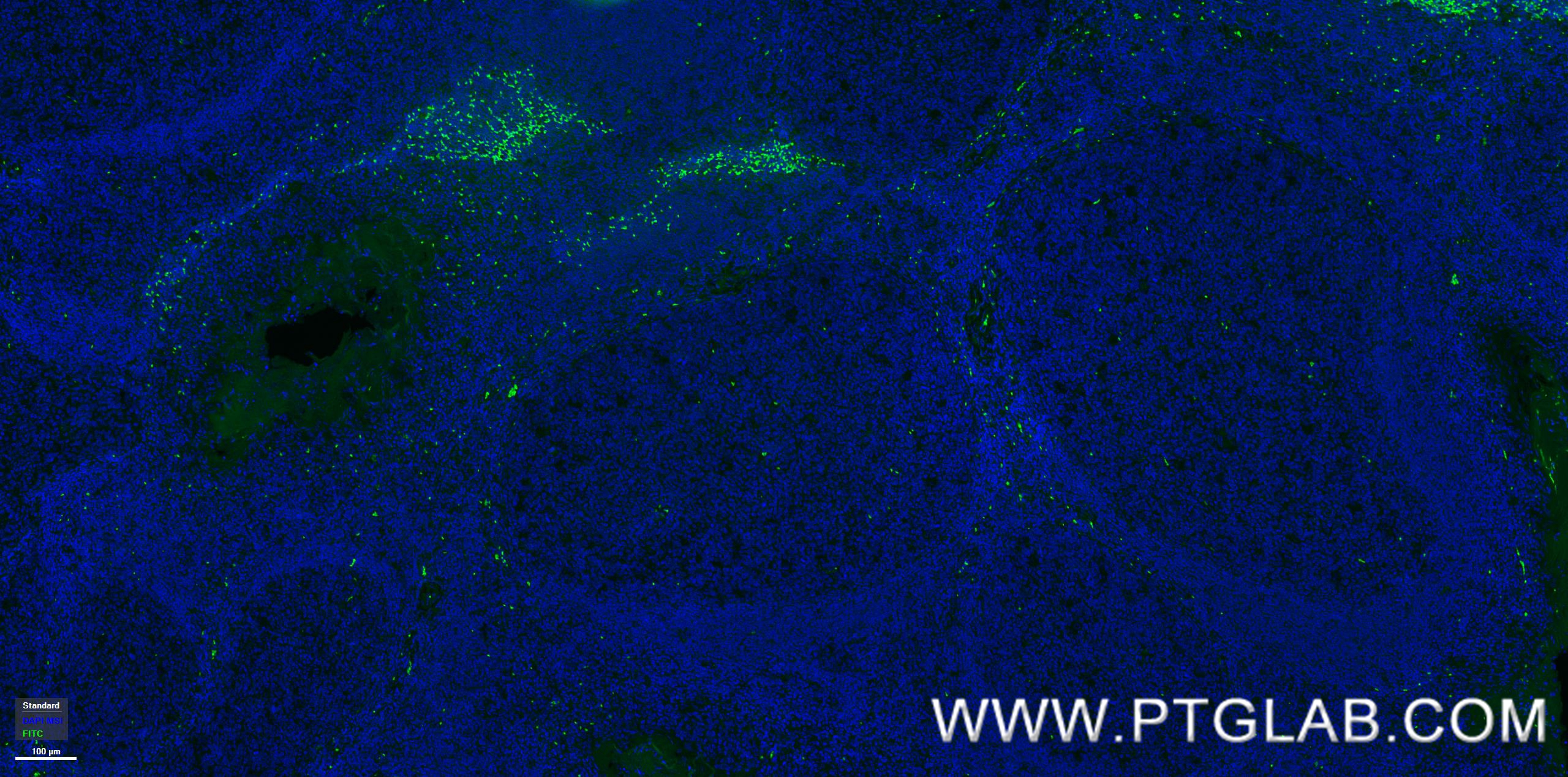 Immunofluorescence (IF) / fluorescent staining of human tonsillitis tissue using Anti-Human TNFRSF9/CD137 Rabbit Recombinant Antibo (98112-1-RR)