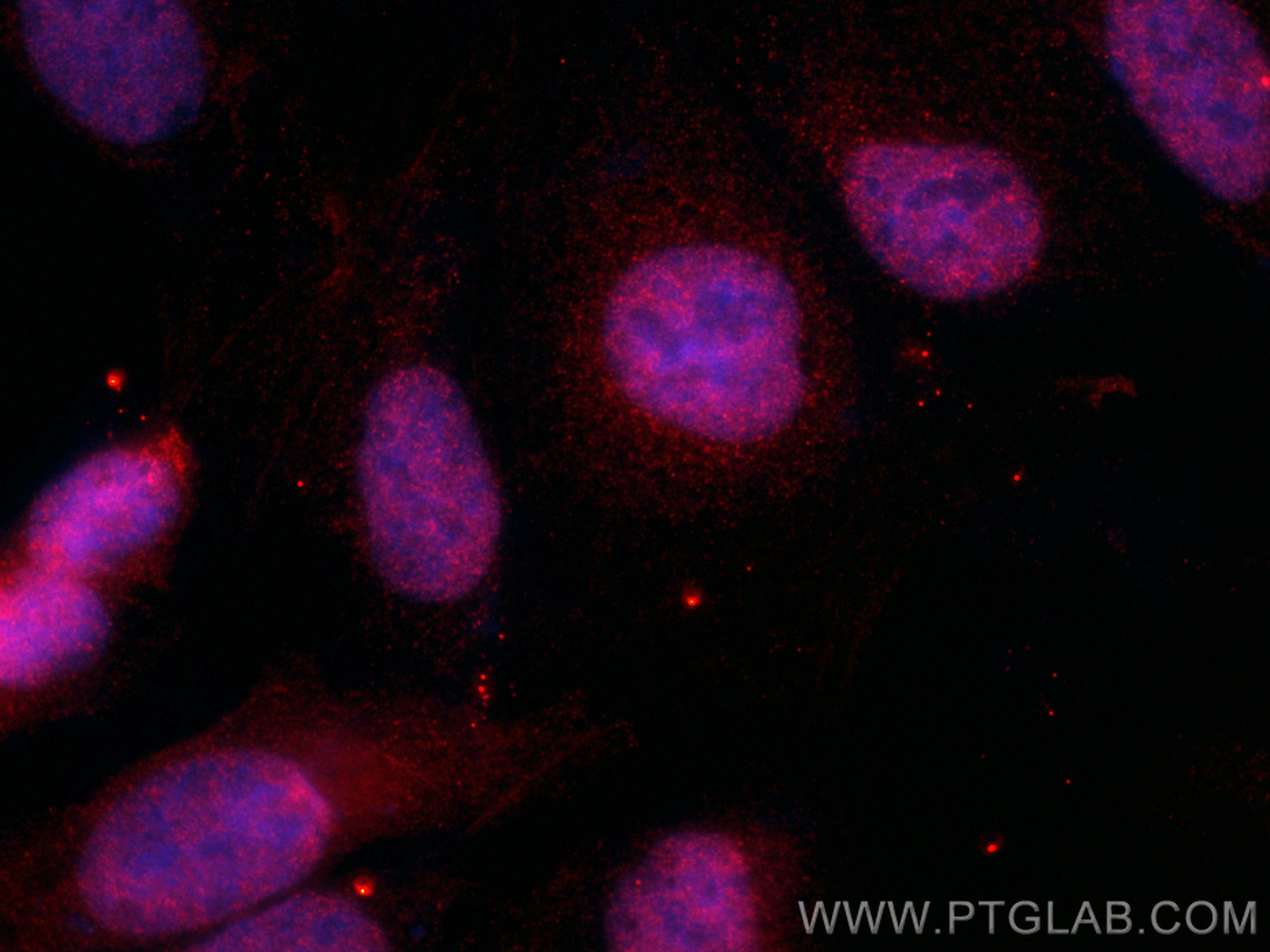 Immunofluorescence (IF) / fluorescent staining of U2OS cells using CoraLite®594-conjugated TNIK Monoclonal antibody (CL594-67948)