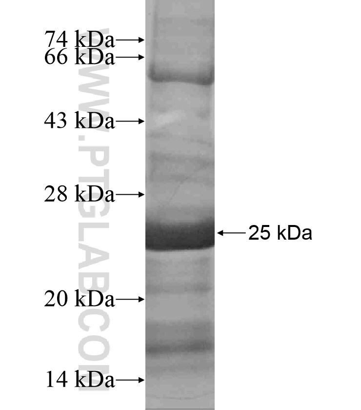 TNMD fusion protein Ag18344 SDS-PAGE