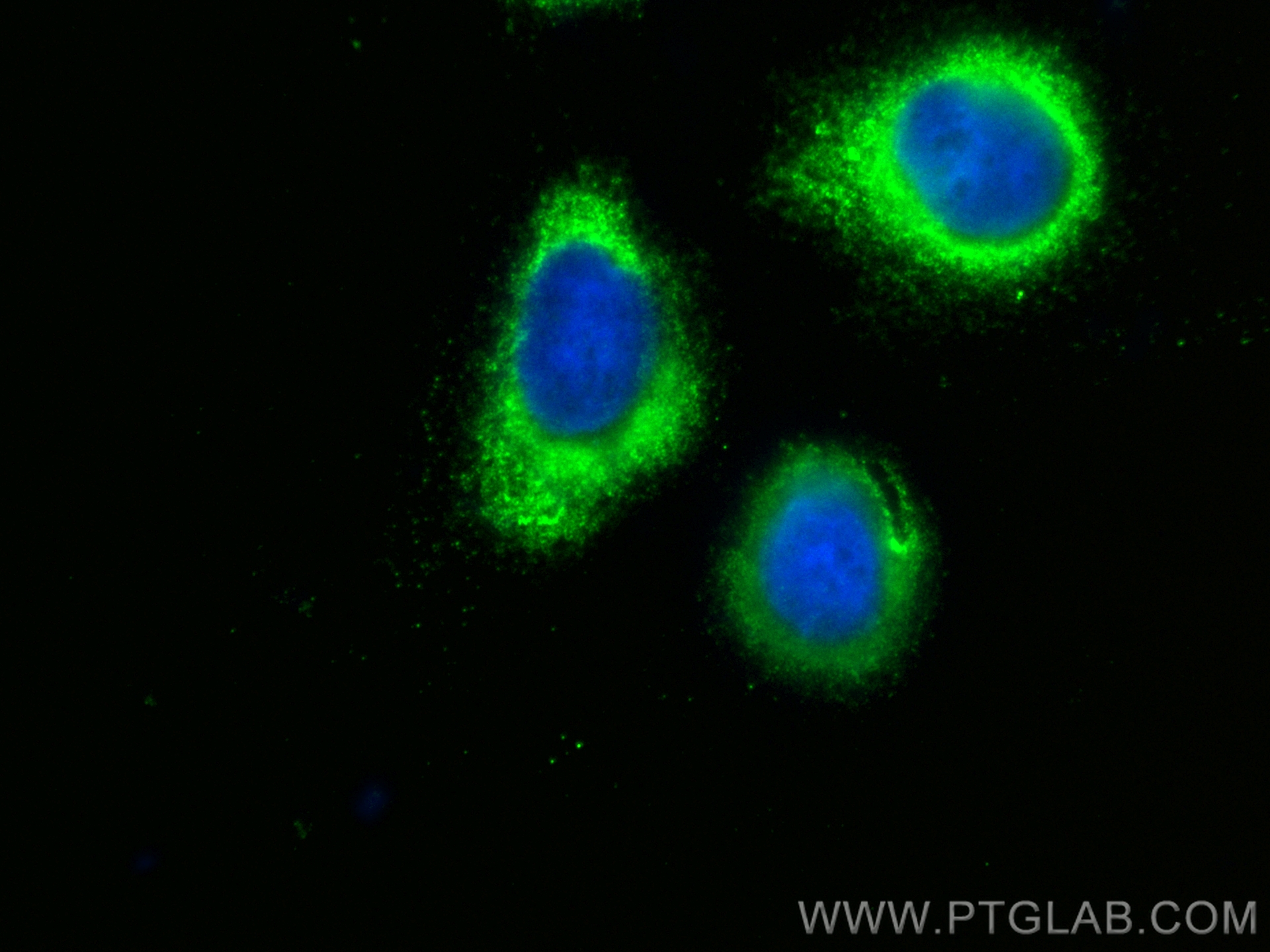 Immunofluorescence (IF) / fluorescent staining of U2OS cells using CoraLite® Plus 488-conjugated TNNC1 Polyclonal ant (CL488-13504)