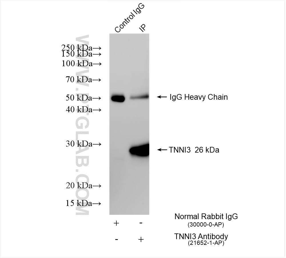 Immunoprecipitation (IP) experiment of mouse heart tissue using Cardiac Troponin I Polyclonal antibody (21652-1-AP)