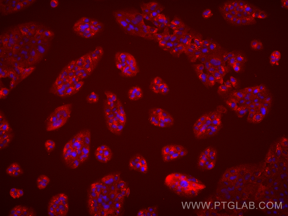 Immunofluorescence (IF) / fluorescent staining of hTERT-RPE1 cells using TNNT1 Monoclonal antibody (68631-1-Ig)