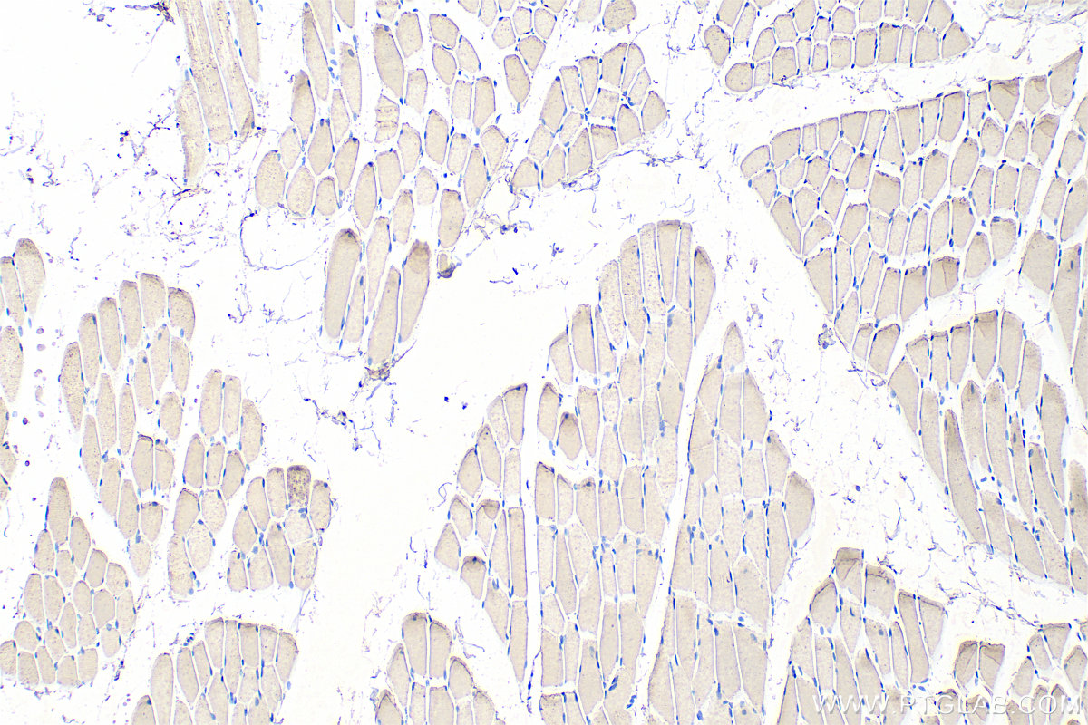 Immunohistochemistry (IHC) staining of rat skeletal muscle tissue using TNNT1 Monoclonal antibody (68631-1-Ig)