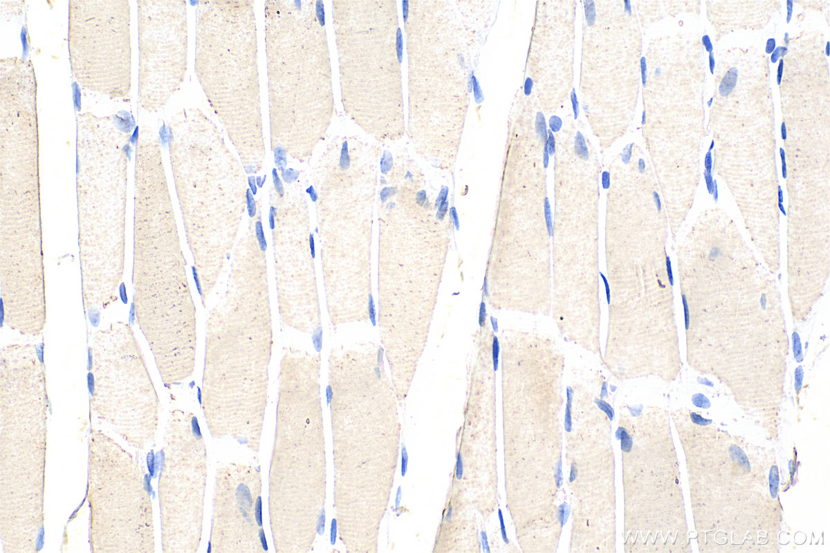 Immunohistochemistry (IHC) staining of rat skeletal muscle tissue using TNNT1 Monoclonal antibody (68631-1-Ig)