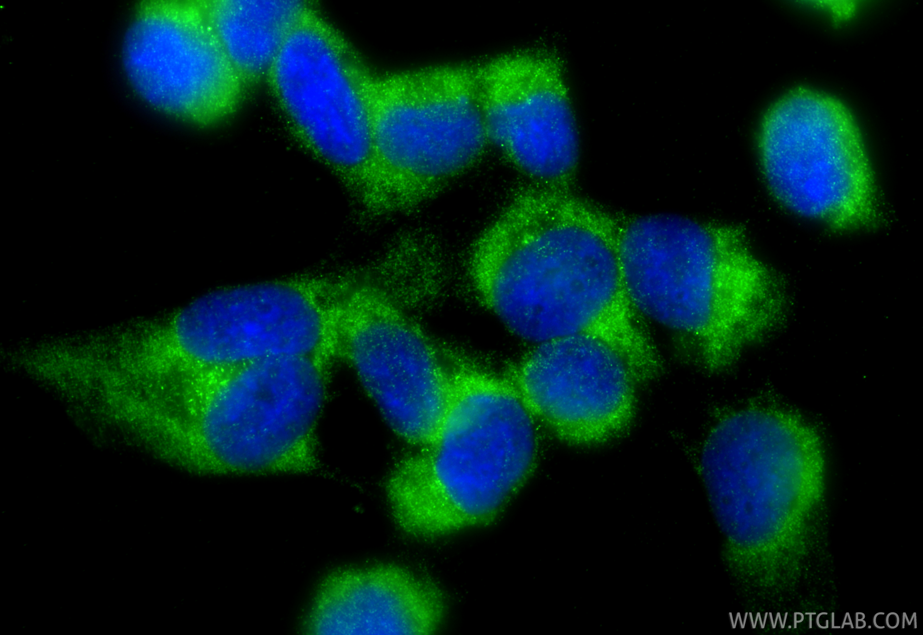 Immunofluorescence (IF) / fluorescent staining of AC16 cells using Cardiac Troponin T Polyclonal antibody (15513-1-AP)