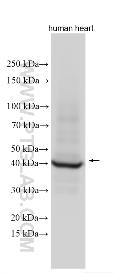 Western Blot (WB) analysis of various lysates using Cardiac Troponin T Polyclonal antibody (15513-1-AP)