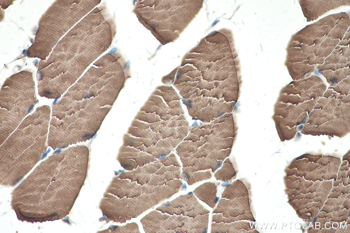 Immunohistochemistry (IHC) staining of mouse skeletal muscle tissue using TNNT3 Polyclonal antibody (19729-1-AP)