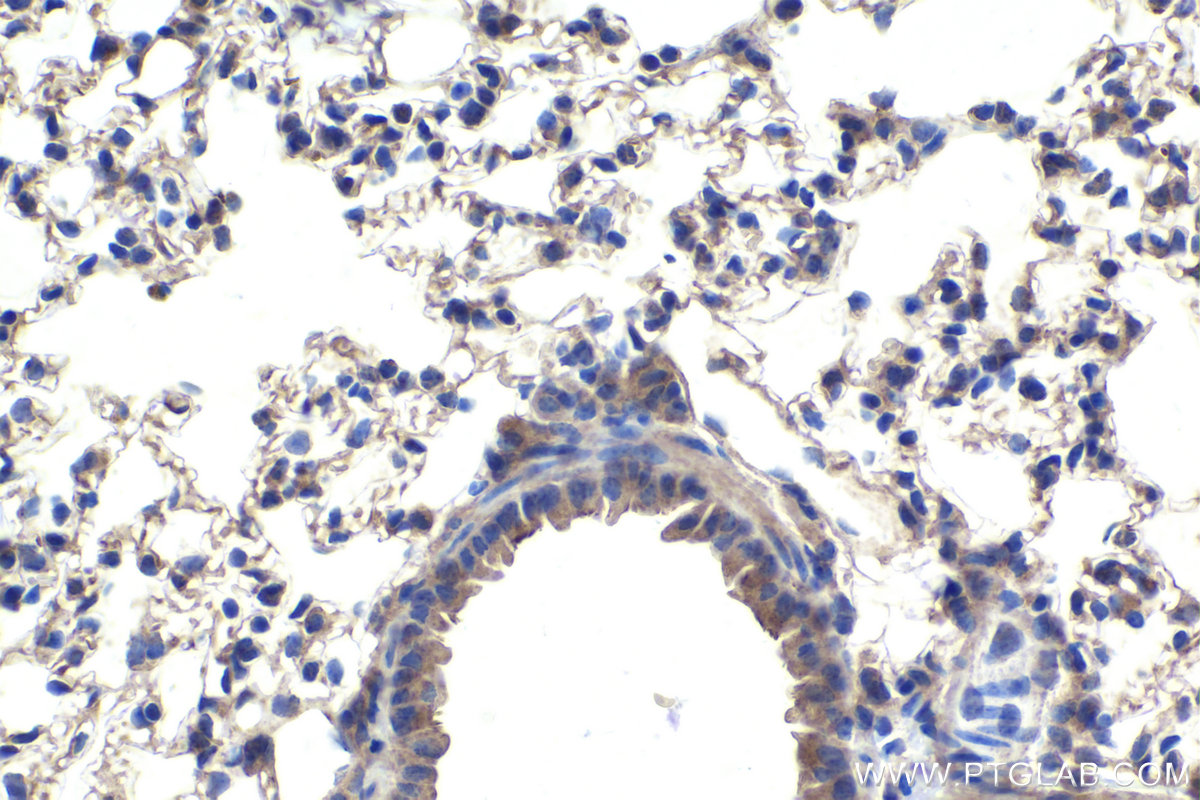 Immunohistochemistry (IHC) staining of mouse lung tissue using TNPO1 Polyclonal antibody (20679-1-AP)