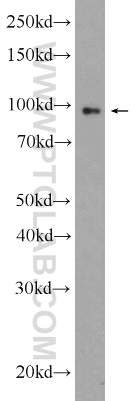 Western Blot (WB) analysis of HEK-293 cells using Transportin-1 Polyclonal antibody (20679-1-AP)