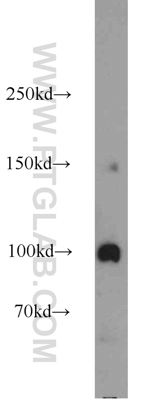 Western Blot (WB) analysis of mouse liver tissue using Transportin-1 Polyclonal antibody (20679-1-AP)