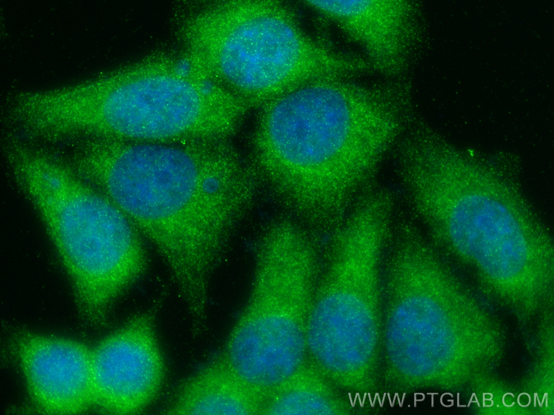 Immunofluorescence (IF) / fluorescent staining of MCF-7 cells using TNPO2 Polyclonal antibody (17831-1-AP)