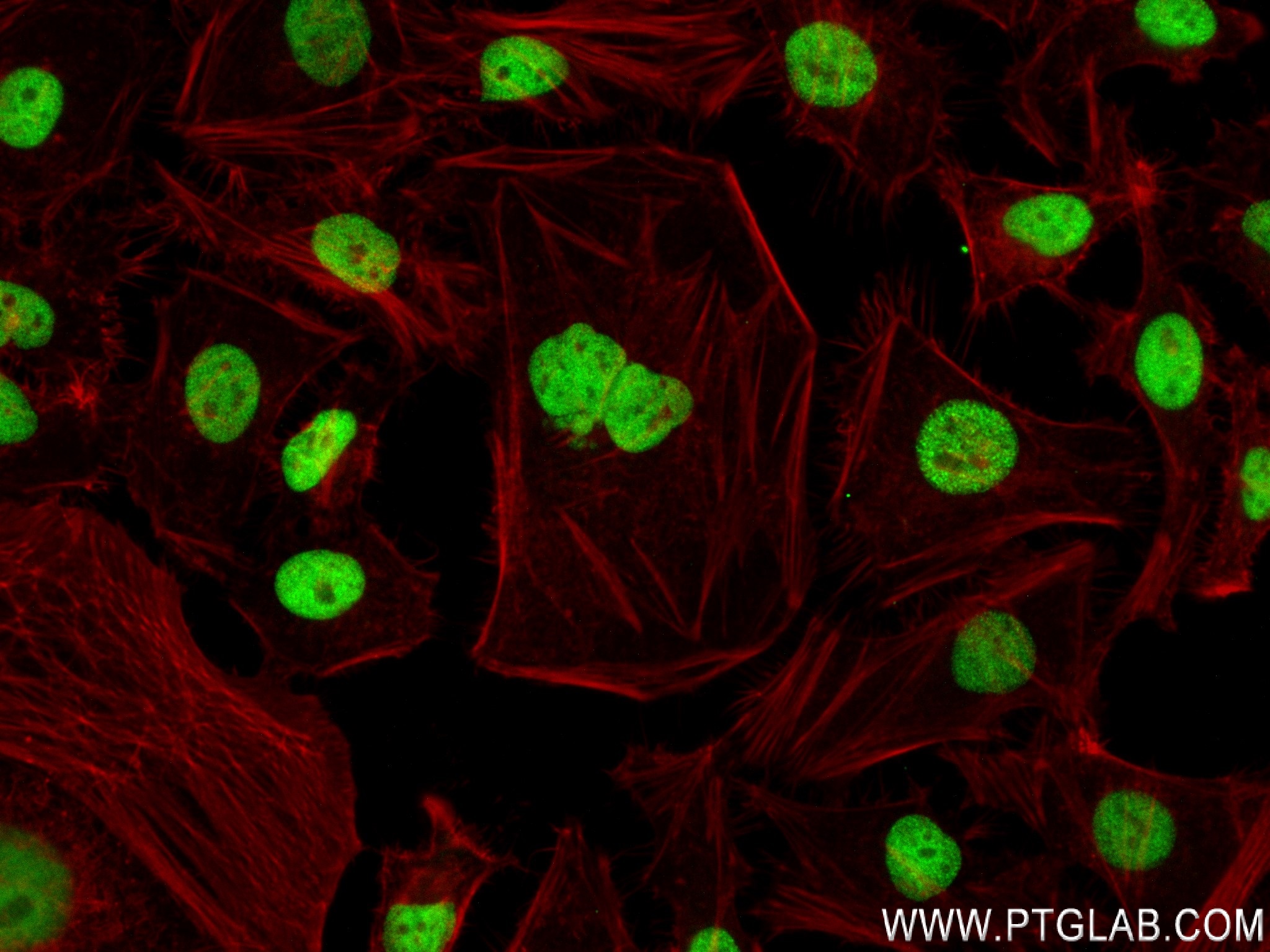 Immunofluorescence (IF) / fluorescent staining of HeLa cells using TOB1 Recombinant antibody (83944-2-RR)